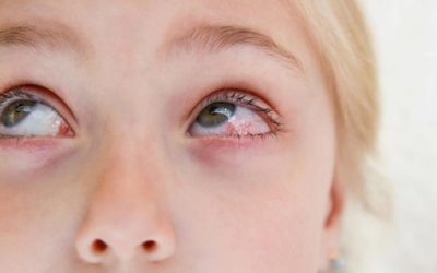 Help Your Student Avoid Pink Eye This School Year